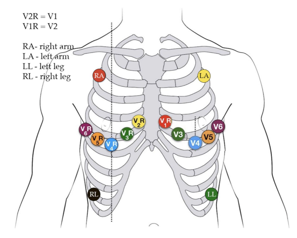Cardeff - domowy monitoring EKG (wersja profesjonalna)