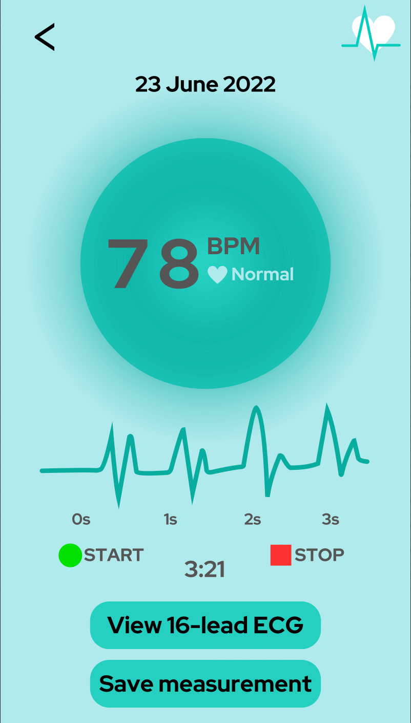 Cardeff - domowy monitoring EKG (wersja konsumencka)