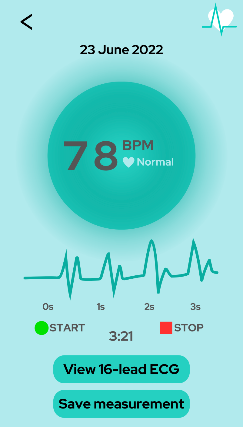 Cardeff - domowy monitoring EKG (wersja profesjonalna)