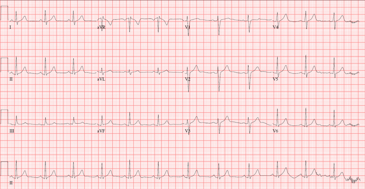 Cardeff - domowy monitoring EKG (wersja profesjonalna)